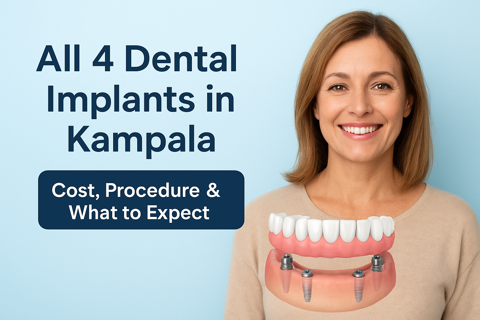 A4 dental implants in Kampala